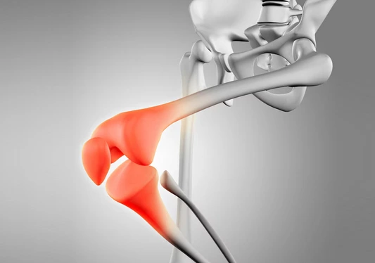 Az ízület felépítése és regenerációs lehetőségei terapia24 3