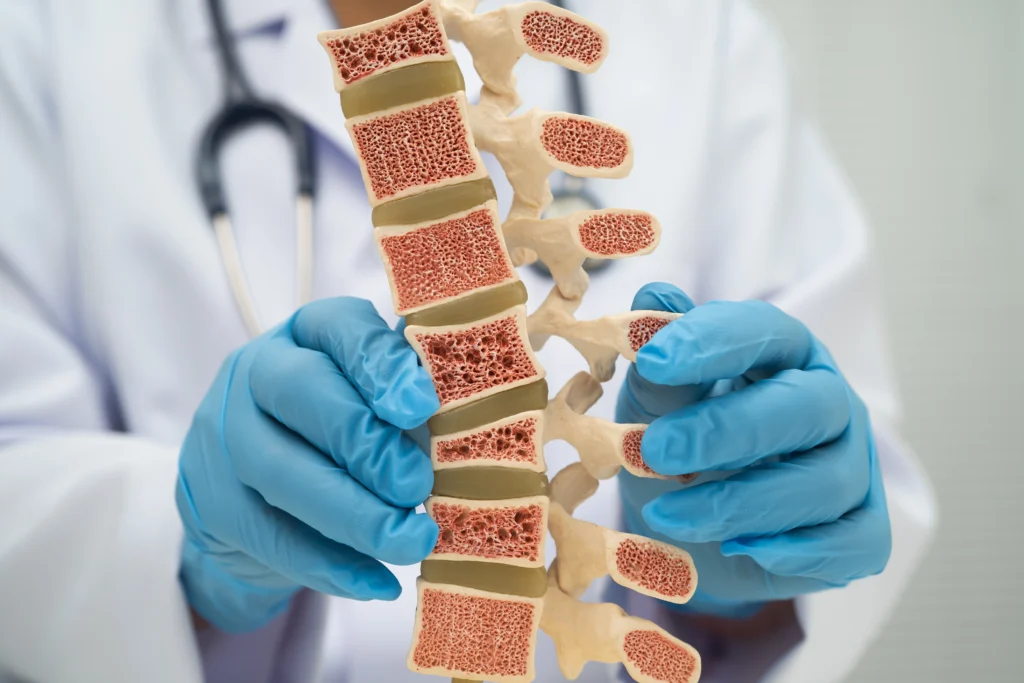 Gerinc eredetű problémák